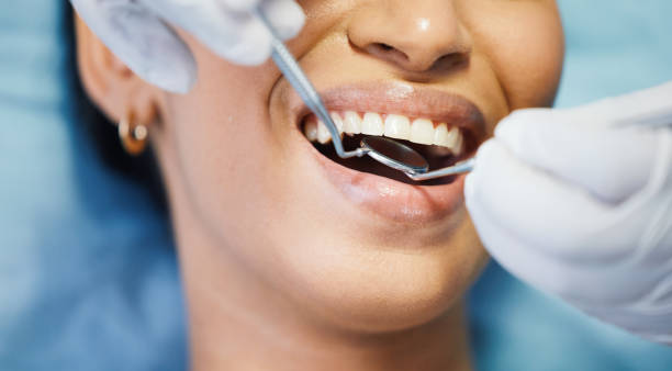 Best Emergency Dentist for Lost Fillings or Crowns in West Plains, MO